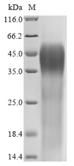 Human Cation channel sperm-associated protein 1 (CATSPER1), partial Recombinant Protein, Homo sapiens (Human), Yeast, C-terminal 6xHis-tagged, 52.7 kDa, purity >≥ 85% as determined by SDS-PAGE.
