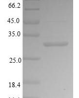 Human Bone sialoprotein 2 (IBSP),Partial Recombinant Protein - BioCrest Sci