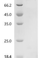 Human Striatin-3 (STRN3) Recombinant Protein - BioCrest Sci