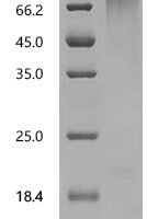 Human Interleukin-10 receptor subunit alpha (IL10RA), partial Recombinant Protein, C-His-Avi - BioCrest Sci