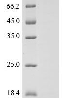 Avian infectious bronchitis virus Non-structural protein 3b (3b) Recombinant Protein, C-His, aa 1–64, strain M41 - BioCrest Sci