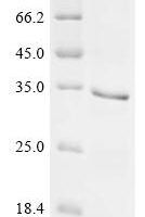 Mouse Dickkopf-related protein 2 (Dkk2) Recombinant Protein - BioCrest Sci