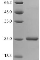 Human immunodeficiency virus type 1 group M subtype C Protein Tat (tat) Recombinant Protein, C-His - BioCrest Sci