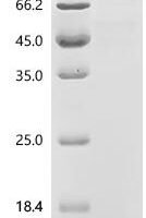 Mouse Protein Wnt-10a (Wnt10a) Recombinant Protein, C-10His-HSA - BioCrest Sci