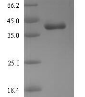 Chicken (Chicken) Mitochondrial Rho GTPase 1 (RHOT1), partial Recombinant Protein - BioCrest Sci