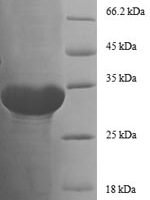 Escherichia coli  50S ribosomal protein L29 (rpmC) Recombinant Protein, N-GST - BioCrest Sci