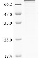 Influenza A virus Polymerase basic protein 2 (PB2) Recombinant Protein, N-10His/C-Myc, aa 1–759, E.coli - BioCrest Sci
