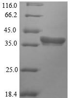 Arabidopsis thaliana  Histone deacetylase HDT2 (HDT2) Recombinant Protein - BioCrest Sci