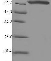 Rat Steroid 17-alpha-hydroxylase/17,20 lyase (Cyp17a1) Recombinant Protein - BioCrest Sci