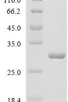 Human Superoxide dismutase [Mn], mitochondrial (SOD2) Recombinant Protein, C-His - BioCrest Sci