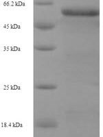 Human Glia-derived nexin (SERPINE2) Recombinant Protein - BioCrest Sci