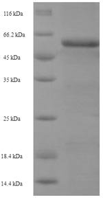 Human Glia-derived nexin (SERPINE2) Recombinant Protein, Homo sapiens (Human), E.coli, N-terminal 6xHis-SUMO-tagged, 57.9 kDa, purity >≥ 90% as determined by SDS-PAGE.