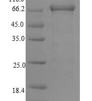 Human DNA mismatch repair protein Msh6 (MSH6), partial Recombinant Protein - BioCrest Sci