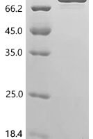 Escherichia coli RNA polymerase sigma factor rpoD (rpoD) Recombinant Protein - BioCrest Sci