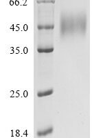 Human Natural killer cell receptor 2B4 (CD244), partial Recombinant Protein, C-His - BioCrest Sci