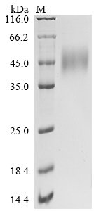 Human Natural killer cell receptor 2B4 (CD244), partial Recombinant Protein, C-His, Homo sapiens (Human), Mammalian cell, C-terminal 6xHis-tagged, 24.5 kDa, purity >≥ 85% as determined by SDS-PAGE.