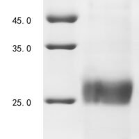 Avian infectious bronchitis virus Spike glycoprotein (S), partial Recombinant Protein, C-His, aa 300–520, strain UK/167/84 - BioCrest Sci
