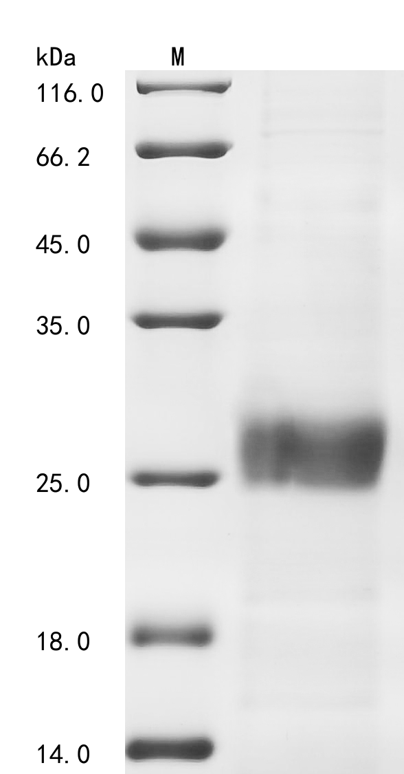 Avian infectious bronchitis virus Spike glycoprotein (S), partial Recombinant Protein, C-His, aa 300–520, strain UK/167/84, Avian infectious bronchitis virus (strain UK/167/84) (IBV), E.coli, C-terminal 6xHis-tagged, 27.1 kDa, purity >≥ 85% as determined by SDS-PAGE.