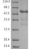 Human Cell cycle checkpoint protein RAD1 (RAD1) Recombinant Protein - BioCrest Sci