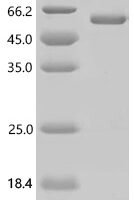 Human 2'-5'-oligoadenylate synthase 1 (OAS1) , partial Recombinant Protein - BioCrest Sci