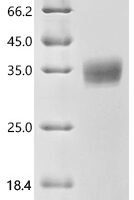 Human Butyrophilin subfamily 1 member A1 (BTN1A1), partial Recombinant Protein - BioCrest Sci