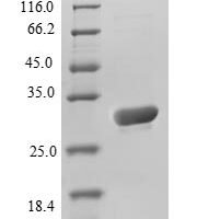 Aequorea victoria Green fluorescent protein (GFP) Recombinant Protein, N-His - BioCrest Sci