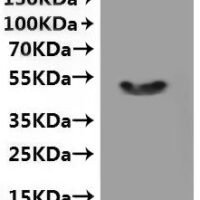Human Transient receptor potential cation channel subfamily M member 8 (TRPM8) , partial-VLPs Recombinant Protein - BioCrest Sci