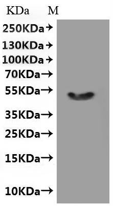 Human Transient receptor potential cation channel subfamily M member 8 (TRPM8) , partial-VLPs Recombinant Protein, Homo sapiens (Human), Mammalian cell, C-terminal 10xHis-tagged(This tag can be tested only under denaturing conditions), 50.5 kDa, purity >VLPs