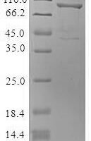 Mouse Cytoskeleton-associated protein 4 (Ckap4), partial Recombinant Protein, N-MBP/C-His - BioCrest Sci