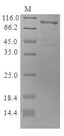 Mouse Cytoskeleton-associated protein 4 (Ckap4), partial Recombinant Protein, N-MBP/C-His, Mus musculus (Mouse), Baculovirus, N-terminal MBP-tagged and C-terminal 6xHis-tagged, 96.6 kDa, purity >≥ 85% as determined by SDS-PAGE.