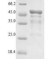 Streptococcus agalactiae Toxin zeta Recombinant Protein - BioCrest Sci