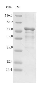 Streptococcus agalactiae Toxin zeta Recombinant Protein, Streptococcus agalactiae, E.coli, N-terminal 6xHis-B2M-tagged, 46.7 kDa, purity >≥ 90% as determined by SDS-PAGE.