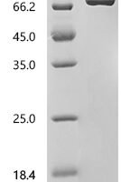 Mouse Osteopontin (Spp1), partial Recombinant Protein, C-10His - BioCrest Sci