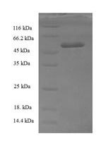 Human Transcription initiation factor IIB (GTF2B) Recombinant Protein - BioCrest Sci