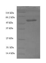 Human Transcription initiation factor IIB (GTF2B) Recombinant Protein, Homo sapiens (Human), E.coli, N-terminal 6xHis-SUMO-tagged, 50.8 kDa, purity >≥ 90% as determined by SDS-PAGE.