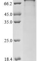 Human Follicle-stimulating hormone receptor (FSHR), partial Recombinant Protein, C-hFc1 - BioCrest Sci