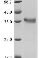 Mouse Mannan-binding protein (Mbl2) Recombinant Protein - BioCrest Sci