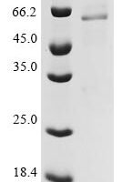 Capsicum annuum Catalase (CAT) Recombinant Protein - BioCrest Sci
