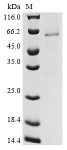 Capsicum annuum Catalase (CAT) Recombinant Protein, Capsicum annuum (Bell pepper), E.coli, N-terminal 10xHis-tagged, 62.5 kDa, purity >≥ 85% as determined by SDS-PAGE.