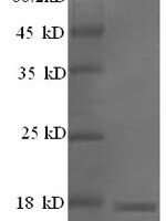 Mouse Major urinary protein 11 (Mup11), partial Recombinant Protein - BioCrest Sci