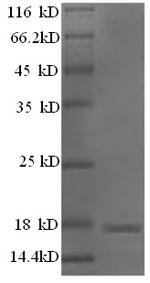 Mouse Major urinary protein 11 (Mup11), partial Recombinant Protein, Mus musculus (Mouse), E.coli, N-terminal 6xHis-tagged, 21.6 kDa, purity >≥ 90% as determined by SDS-PAGE.