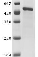Moloney murine leukemia virus Envelope glycoprotein (env), partial Recombinant Protein - BioCrest Sci