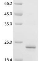 Human Activating signal cointegrator 1 complex subunit 3 (ASCC3) Recombinant Protein, C-His - BioCrest Sci