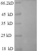 Rat Dipeptidyl aminopeptidase-like protein 6 (DPP6), partial Recombinant Protein - BioCrest Sci