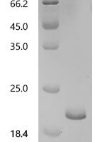 Mouse Lutropin subunit beta (Lhb) Recombinant Protein - BioCrest Sci