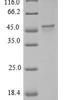 Chicken Myosin light chain kinase, smooth muscle (Mylk), partial Recombinant Protein - BioCrest Sci