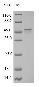 Chicken Myosin light chain kinase, smooth muscle (Mylk), partial Recombinant Protein, Gallus gallus (Chicken), E.coli, N-terminal 10xHis-SUMO-tagged and C-terminal MYC-tagged, 52.9 kDa, purity >≥ 90% as determined by SDS-PAGE.