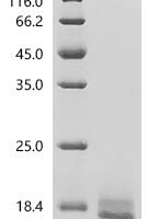 Human Seizure protein 6 homolog (SEZ6), partial Recombinant Protein, N-Myc/C-10His - BioCrest Sci