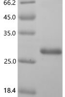 Mouse Pleiotrophin (Ptn) Recombinant Protein, C-His - BioCrest Sci