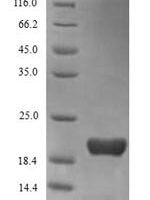 Human Triggering receptor expressed on myeloid cells 2 (TREM2), partial Recombinant Protein - BioCrest Sci